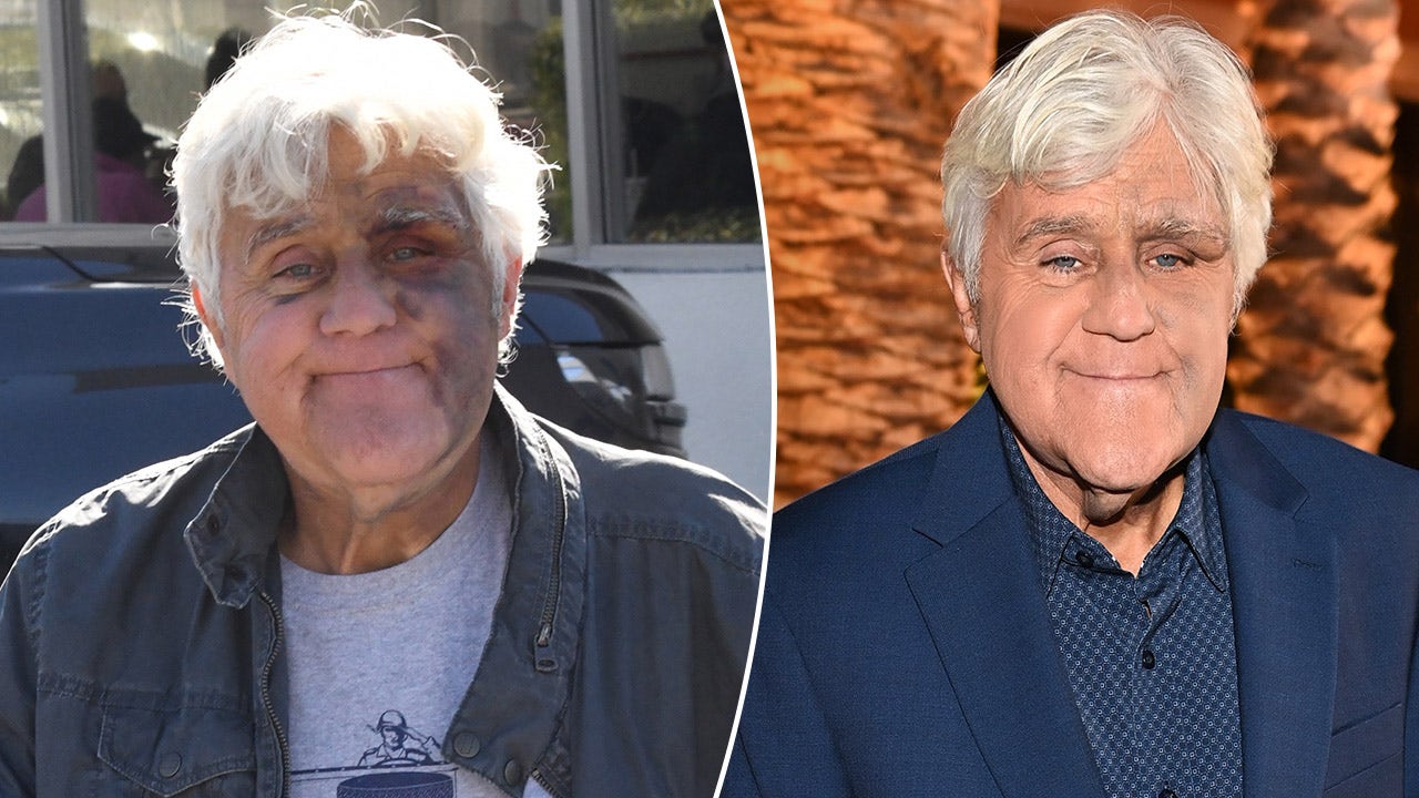 jay-leno-resilience-recovery